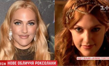 Роксолана зробила пластику!