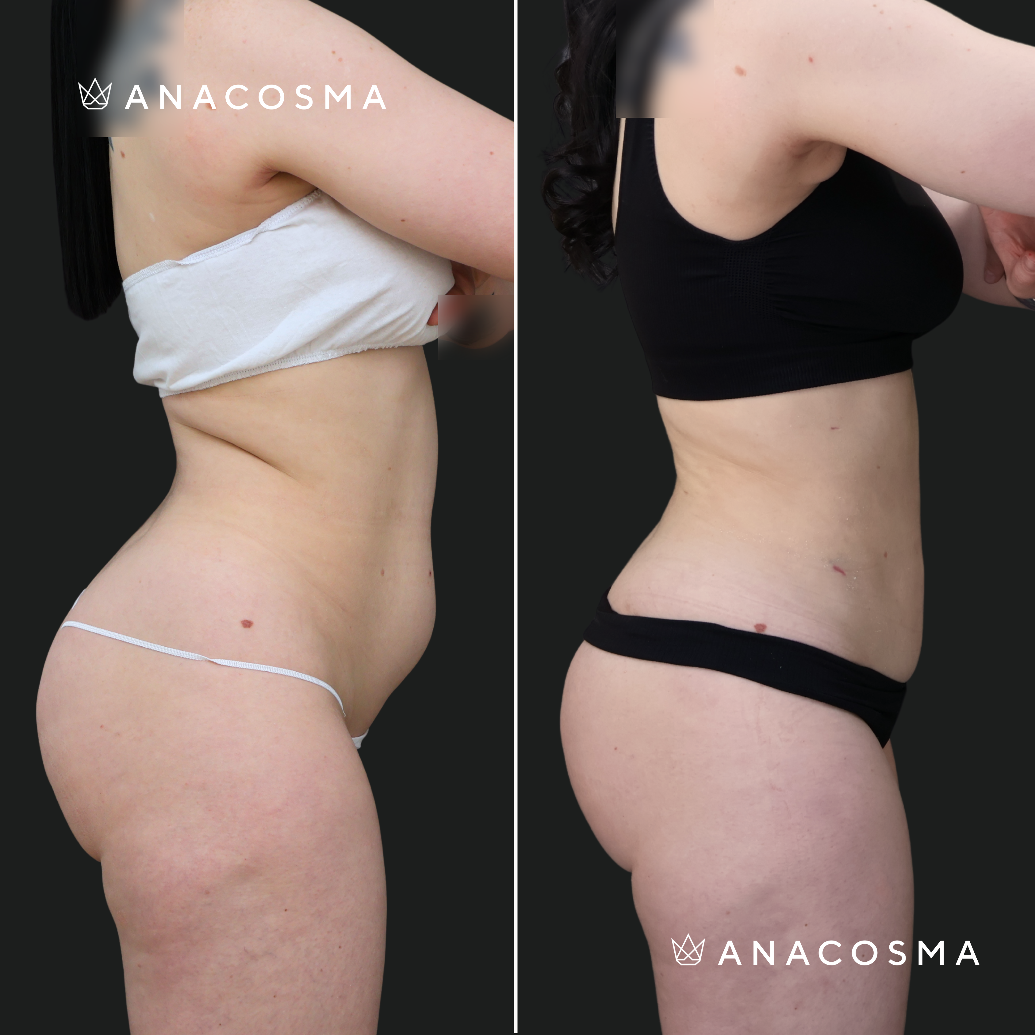Andriy Myronov before and after - Photo 6