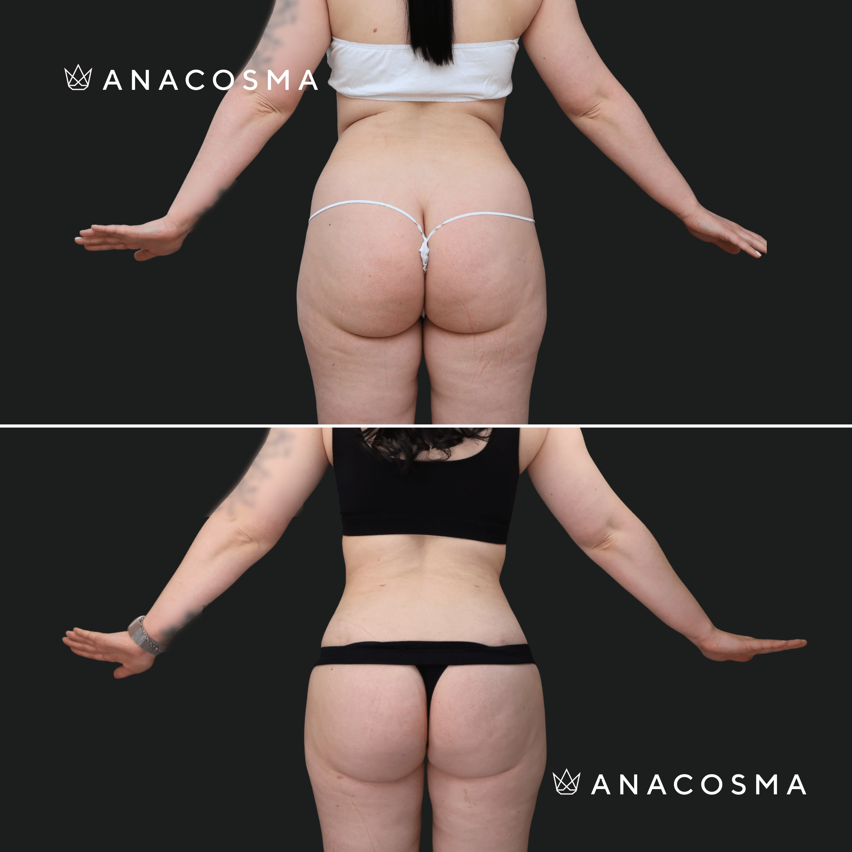 Andriy Myronov before and after - Photo 4