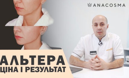 СМАС ЛІФТІНГ АЛЬТЕРА 🔥 ВІД ЧОГО ЗАЛЕЖАТЬ ЦІНА І РЕЗУЛЬТАТ