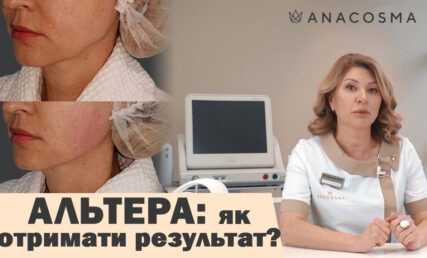 СМАС ЛІФТІНГ АЛЬТЕРА 💥 ЯК ОТРИМАТИ КРАЩИЙ РЕЗУЛЬТАТ ?