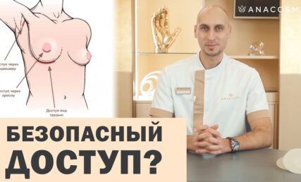 УВЕЛИЧЕНИЕ ГРУДИ ИМПЛАНТАМИ 🍒 ДОСТУПЫ. КАКОЙ ЛУЧШЕ?👨🏼‍⚕️