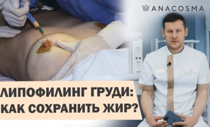 ЛИПОФИЛИНГ ГРУДИ 🍒 УВЕЛИЧЕНИЕ ГРУДИ ЖИРОМ 🔥 КАК СОХРАНИТЬ РЕЗУЛЬТАТ❓