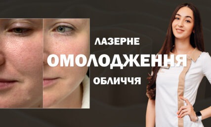 ЛАЗЕРНЕ ОМОЛОДЖЕННЯ ОБЛИЧЧЯ ⁉️ DERMA GENESIS