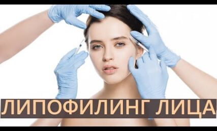 Тарас Баранов, пластичний хірург ANACOSMA, про ліпофілінг обличчя