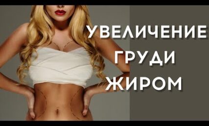 About lipofilling
