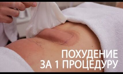 Про апаратне схуднення Сristal