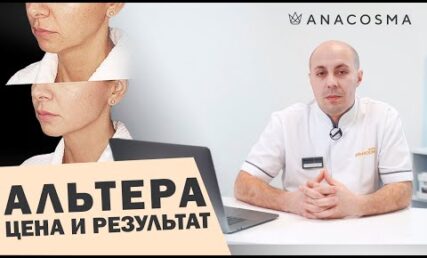 СМАС ЛИФТИНГ АЛЬТЕРА 🔥 ОТ ЧЕГО ЗАВИСЯТ ЦЕНА И РЕЗУЛЬТАТ