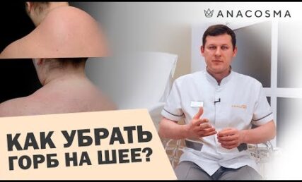 Як позбавитися горбу на спині?