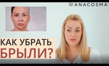 Як позбавитись брилей без операції?