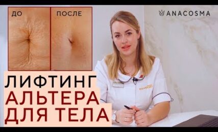 СМАС ліфтинг Альтера для ТІЛА 🔥 Прибрати в'ялий живіт, руки, коліна