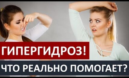 Лікування гіпергідрозу: що реально допомагає?