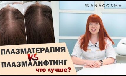 Плазмотерапія VS плазмоліфтинг 🔥Що краще❓