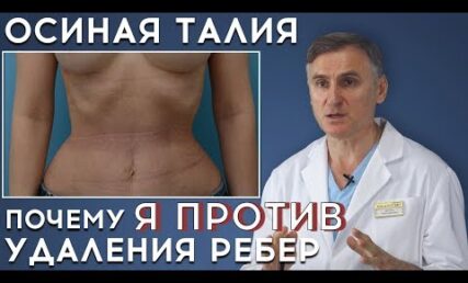 ОСИНА ТАЛІЯ: ЧОМУ Я ПРОТИ ВИДАЛЕННЯ РЕБЕР