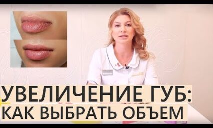 💋 ЗБІЛЬШЕННЯ ГУБ: 💋 скільки потрібно мл гіалуронки в губи? 💋