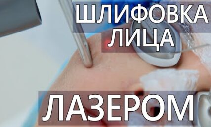 Лазерне шліфування. Небезпечно?