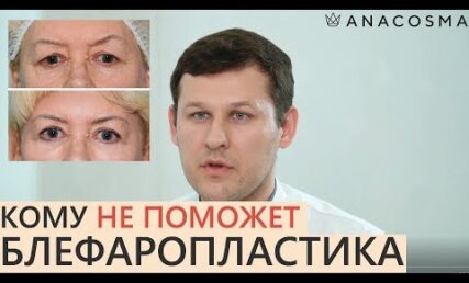 Кому не допоможе блефаропластика