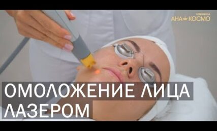 Процедура лазерного омолодження шкіри: стимулює вироблення колагену і шкіра стає пружною, еластичною, набуває здорового вигляду!