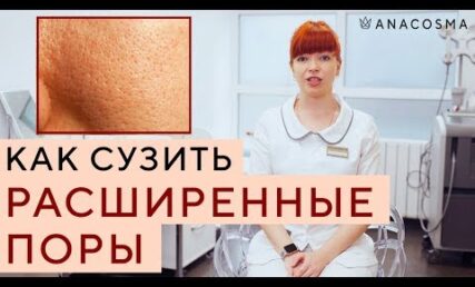 Як звузити широкі пори