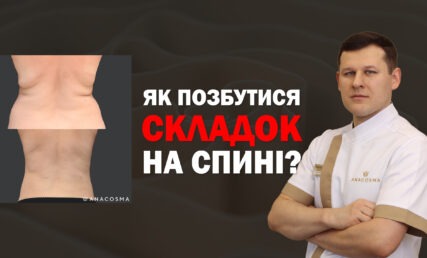 ЯК ПРИБРАТИ СКЛАДКИ НА СПИНІ⁉️ЯК ПРИБРАТИ ЖИР НА СПИНІ?🧐 ЛІПОСАКЦІЯ СПИНИ