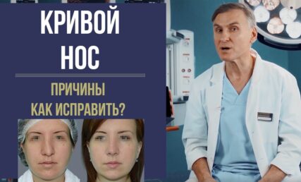 Кривой нос? Причины. Как исправить?