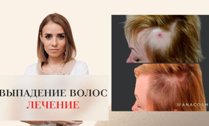 ЛЕЧЕНИЕ ВОЛОС: КОМУ КАКИЕ ПРОЦЕДУРЫ?