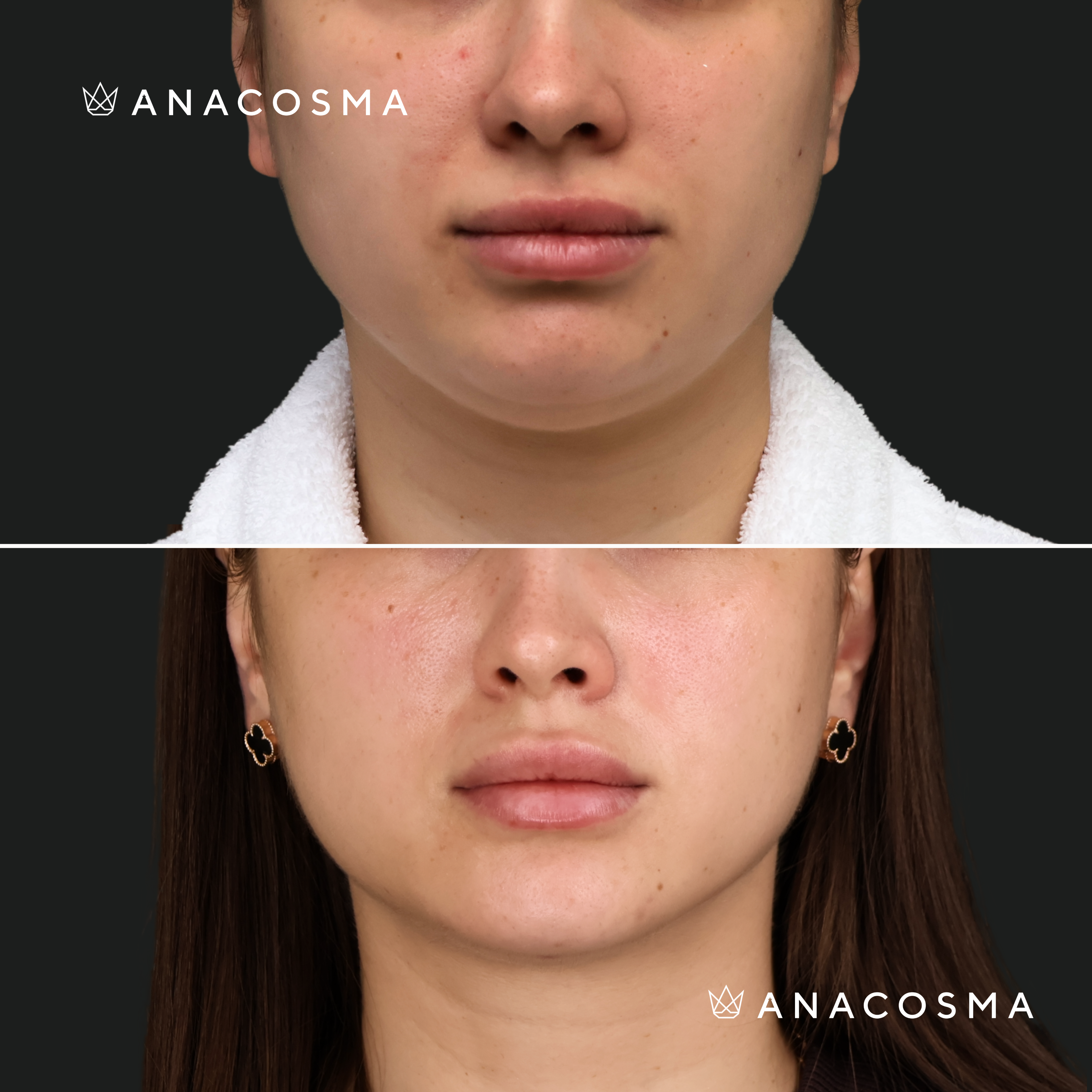 Andriy Myronov before and after - Photo 1