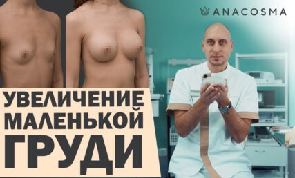 УВЕЛИЧЕНИЕ МАЛЕНЬКОЙ ГРУДИ 🍒 МАММОПЛАСТИКА 🔥 ИМПЛАНТЫ ДЛЯ НУЛЕВОГО РАЗМЕРА