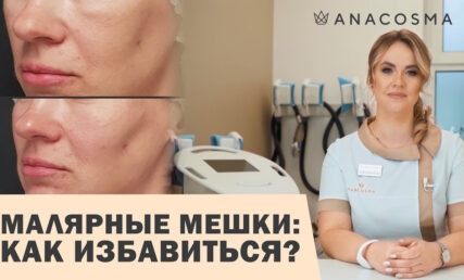 МАЛЯРНЫЕ МЕШКИ ❌Как избавиться⁉️
