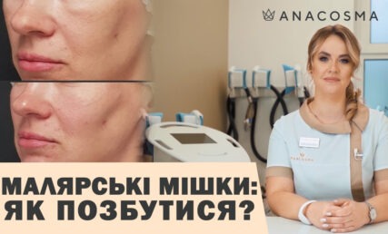SMAS-ліфтинг АЛЬТЕРА Prime - Фото 1