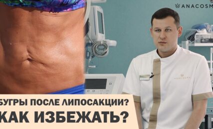 БУГРИ ТА НЕРІВНОСТІ ПІСЛЯ ЛІПОСАКЦІЇ⛔️ ЩО РОБИТИ?