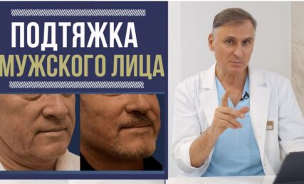 ПІДТЯЖКА ОБЛИЧЧЯ У ЧОЛОВІКІВ👉 ЯКІ ОСОБЛИВОСТІ?
