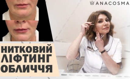 Як вибрати нитки?