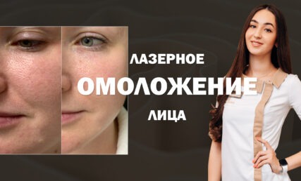 ЛАЗЕРНОЕ ОМОЛОЖЕНИЕ ЛИЦА ⁉️