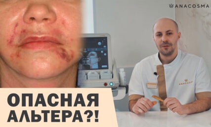 УЛЬТРАЗВУКОВОЙ СМАС ЛИФТИНГ ⛔ ОСТОРОЖНО ⚠️‼️ ОПАСНАЯ АЛЬТЕРА