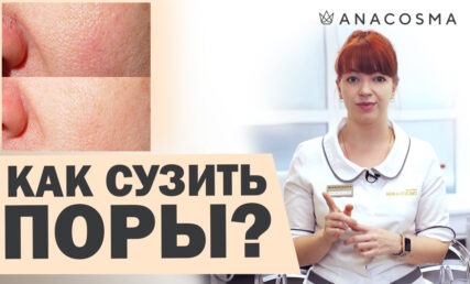РАСШИРЕННЫЕ ПОРЫ 🚫 КАК СУЗИТЬ ПОРЫ НА ЛИЦЕ