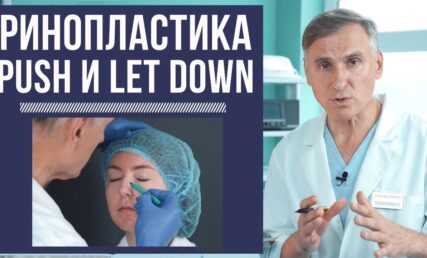 ❗️РИНОПЛАСТИКА LET DOWN И PUSH DOWN❗️ КАКОЙ МЕТОД ЛУЧШЕ?