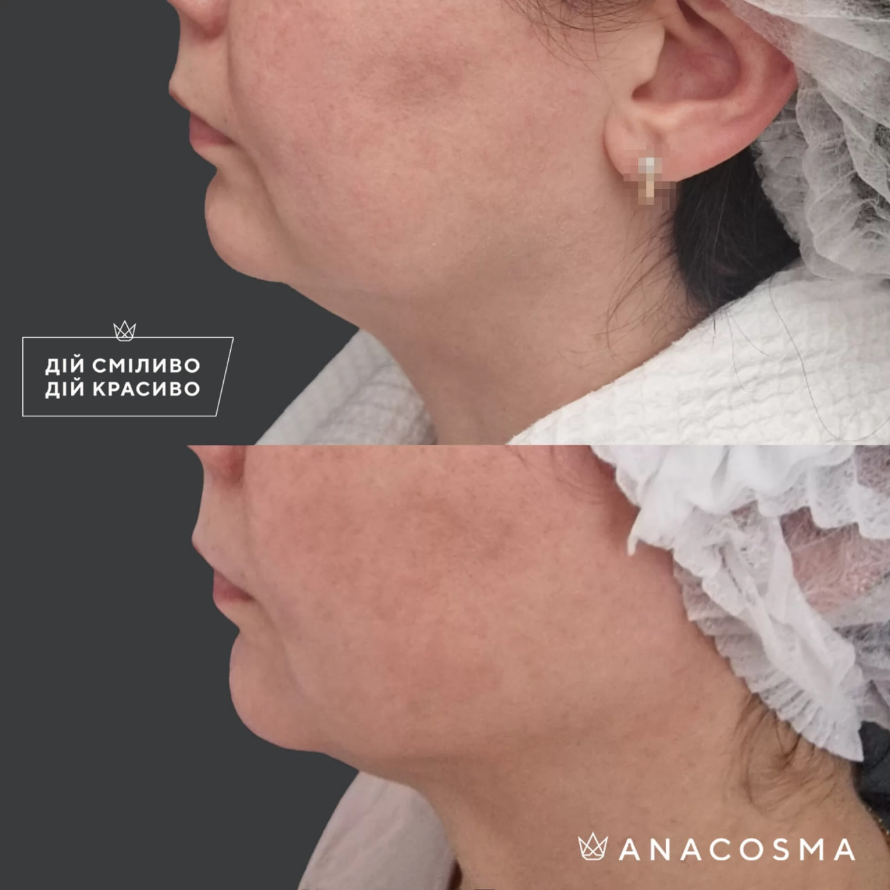 Макаренко Оксана Олегівна до і після - Фото 1