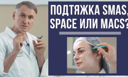 ❗️ПІДТЯЖКА ОБЛИЧЧЯ MACS-/ SPACE-/ SMAS-ЛИФТИНГ: ЩО КРАЩЕ?