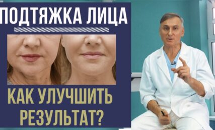 ПІДТЯЖКА ОБЛИЧЧЯ: ЯК ПОКРАЩИТИ ТА ПРОДОВЖИТИ РЕЗУЛЬТАТ
