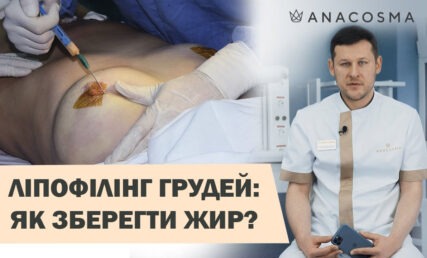 ЛІПОФІЛІНГ ГРУДЕЙ🍒 ЗБІЛЬШЕННЯ ГРУДЕЙ ЖИРОМ 🔥 ЯК ЗБЕРЕГТИ РЕЗУЛЬТАТ❓