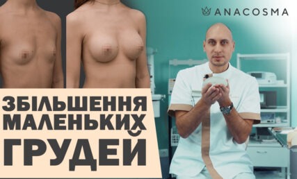 ЗБІЛЬШЕННЯ МАЛЕНЬКИХ ГРУДЕЙ 🍒 МАММОПЛАСТИКА 🔥 ІМПЛАНТИ ДЛЯ НУЛЬОВОГО РОЗМІРУ