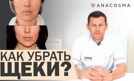 КАК УБРАТЬ ЩЕКИ?