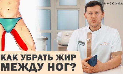 ЛИПОСАКЦИЯ ВНУТРЕННЕЙ СТОРОНЫ БЕДРА: ОПАСНАЯ ЗОНА? ❌ КАК УБРАТЬ ЖИР МЕЖДУ НОГ?🔥