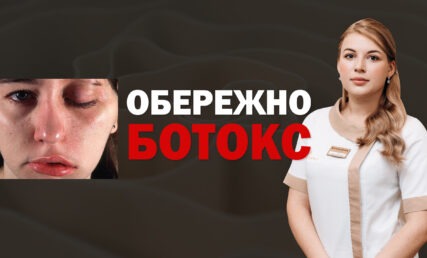 УСКЛАДНЕННЯ ПІСЛЯ БОТОКСУ, ДИСПОРТУ, КСЕОМІНУ ‼️💉 ПТОЗ ПОВІК, ОСУНЕННЯ БРІВ ❌