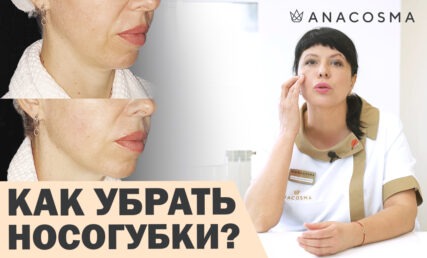 КАК УБРАТЬ НОСОГУБНЫЕ СКЛАДКИ❓ БЕЗ ОПЕРАЦИИ 🔥