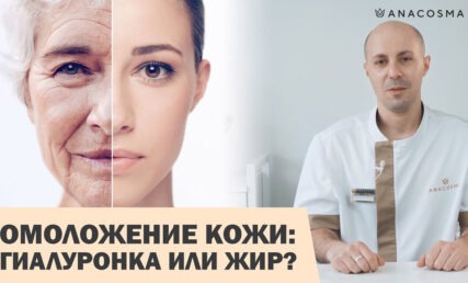 МОРЩИНЫ НА ЛИЦЕ И ДРЯБЛАЯ КОЖА ☘️ ЧТО ЛУЧШЕ: ГИАЛУРОНОВАЯ КИСЛОТА ИЛИ НАНОЛИПОГРАФТИНГ⁉️⚡️