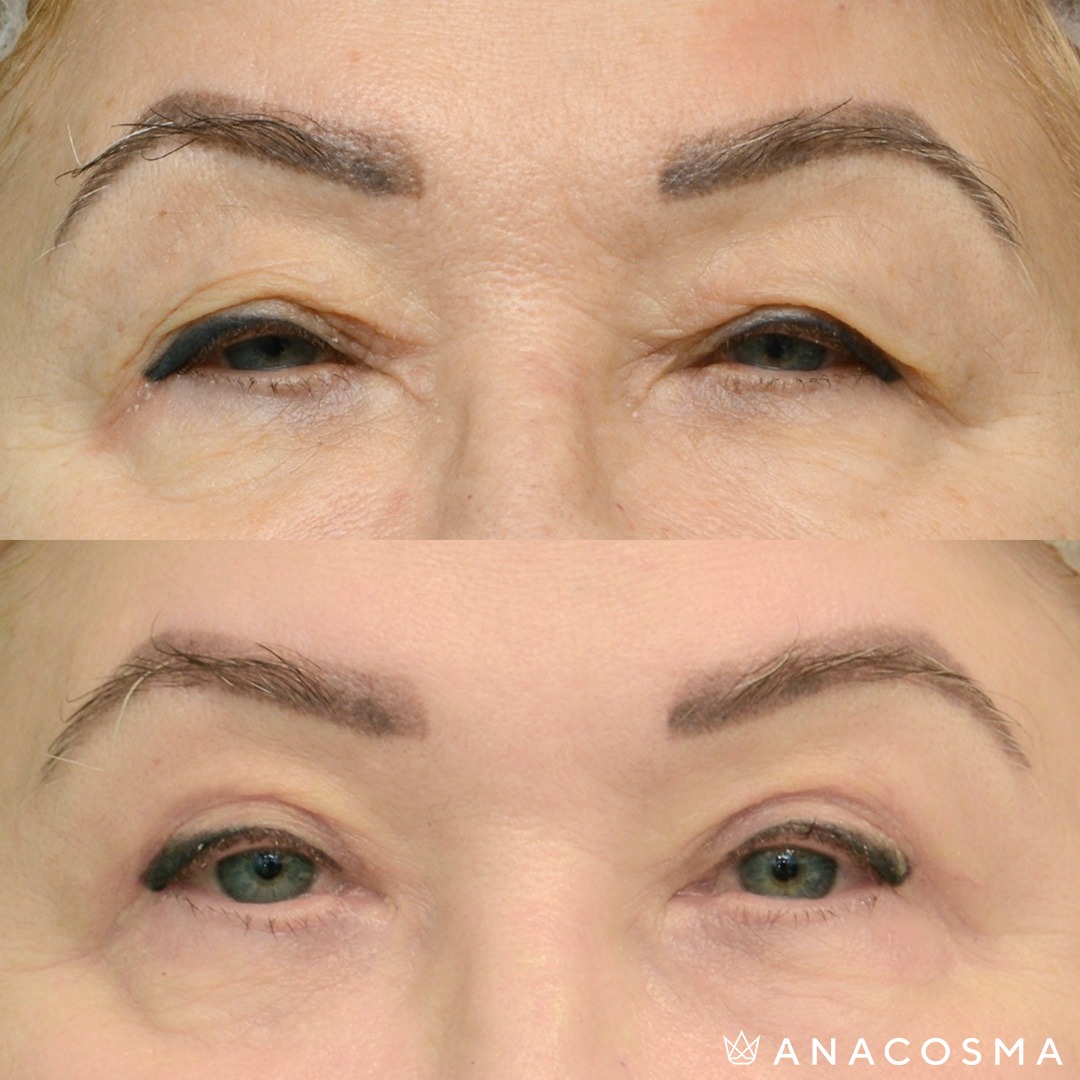 Andriy Myronov before and after - Photo 3