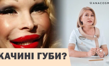ПЕРЕКАЧАНІ ГУБИ⛔️КАЧИНІ ГУБИ💋 🦆 ЯК УНИКНУТИ?