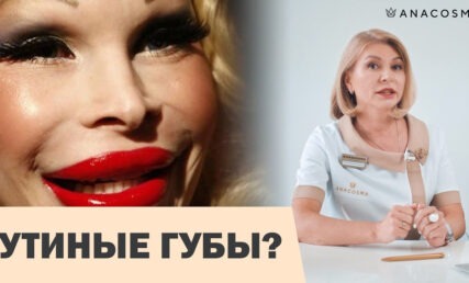 ПЕРЕКАЧЕННЫЕ ГУБЫ ⛔️💋 ГУБЫ УТОЧКОЙ 🦆 КАК ИЗБЕЖАТЬ?